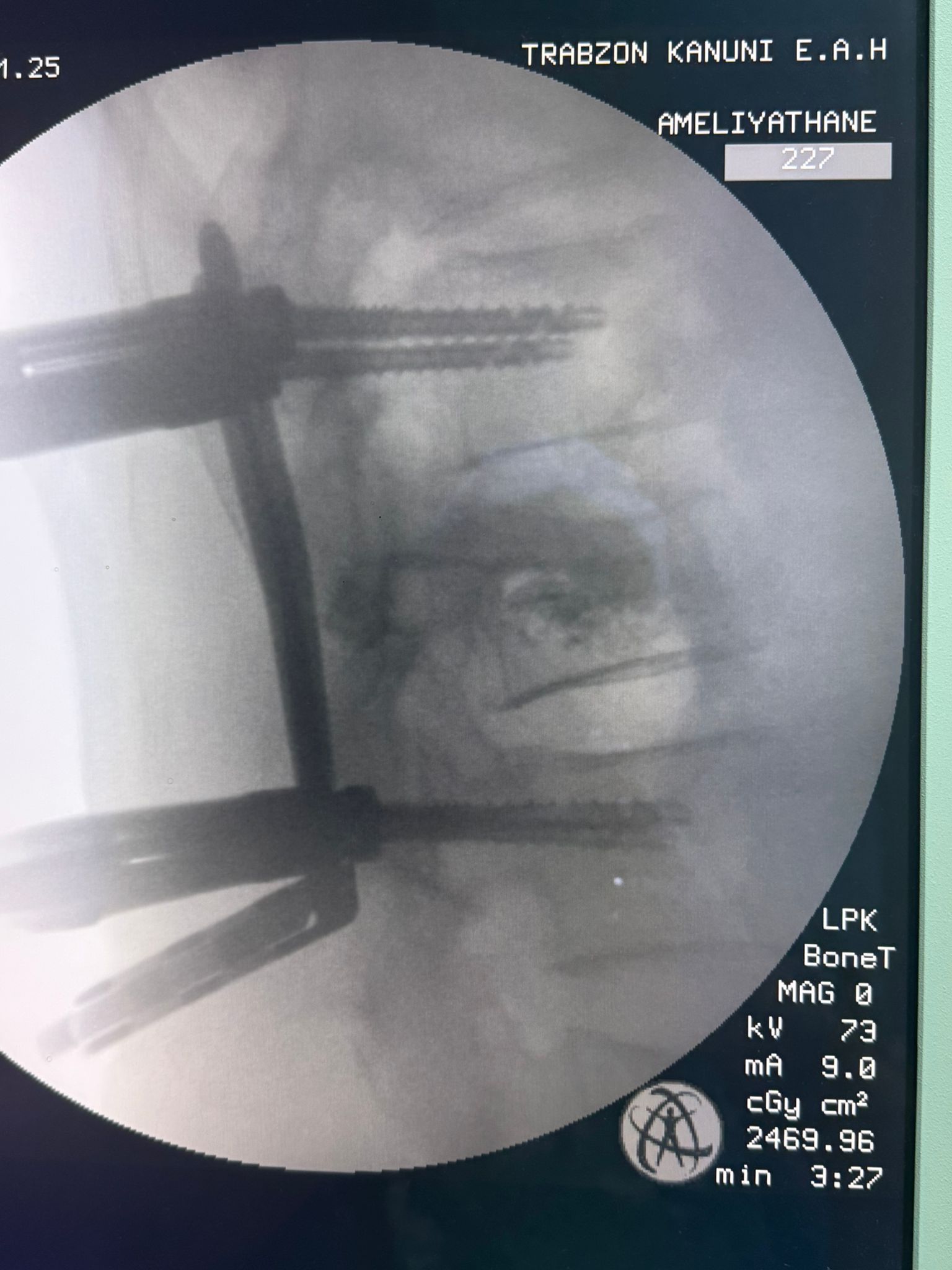 A A 20251112 39691894 39691893 T R A B Z O N D A O M U R G A V I D A L A M A A M E L I Y A T I G E C I R E N H A S T A S A G L I G I N A K A V U S T U