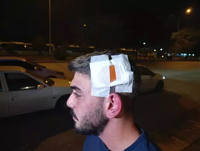 Komsu Dehseti Babanin Dislerini Kirdi Anneyle 19321167 7427 M