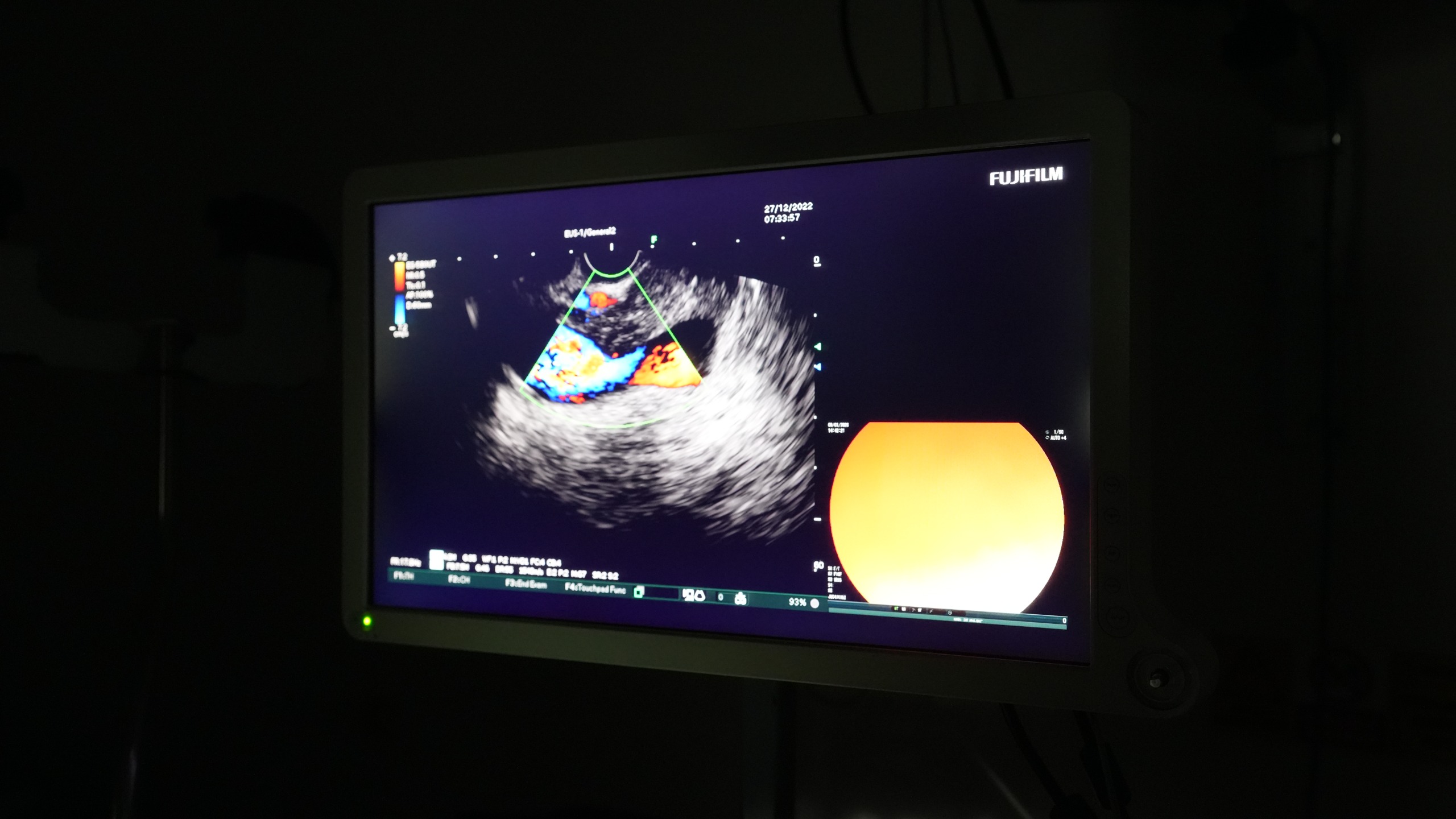 Af0F6Fab C35C 489F A238 5Bd78D5882F5