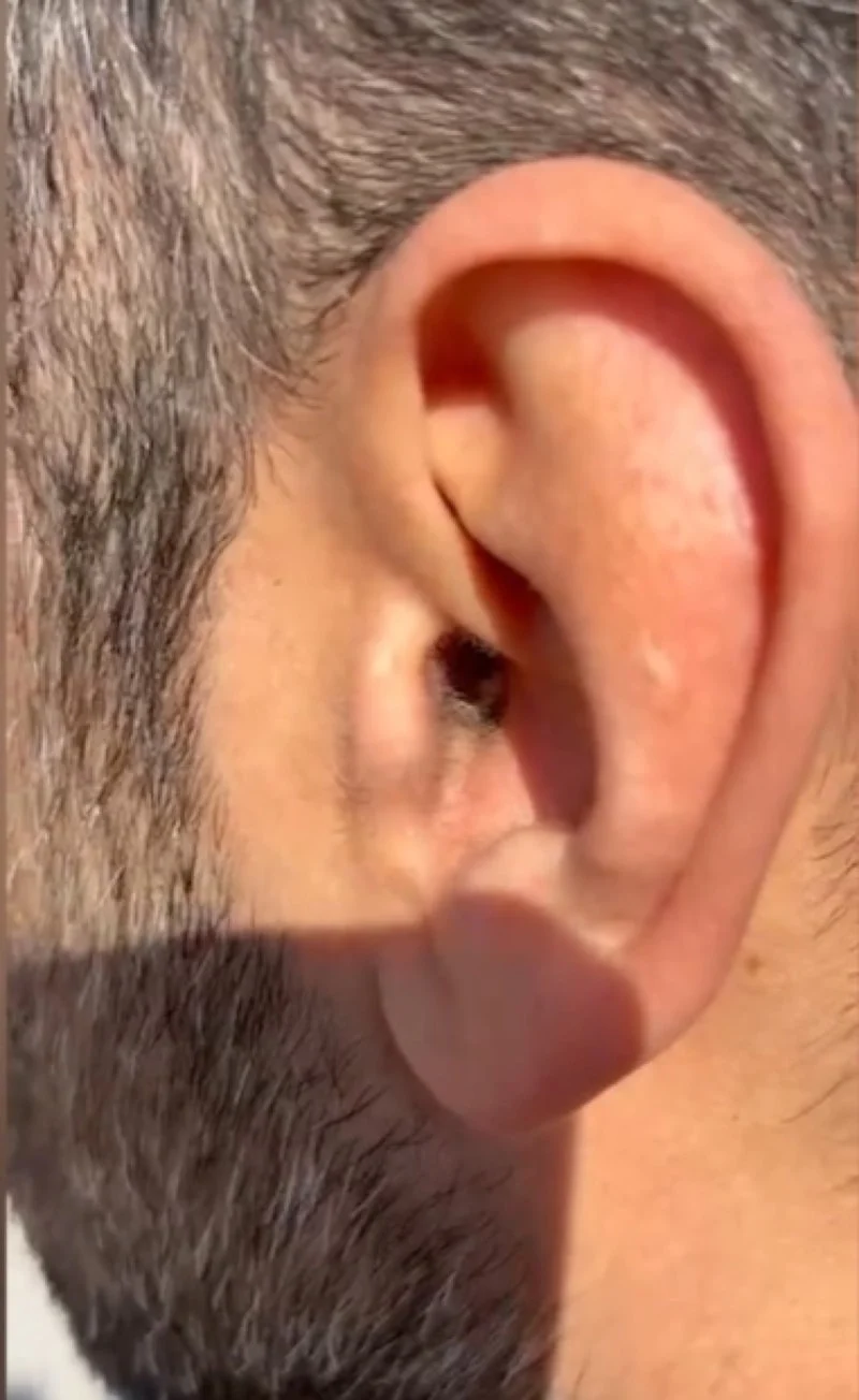 69C623230471B918 W1200Xh1956