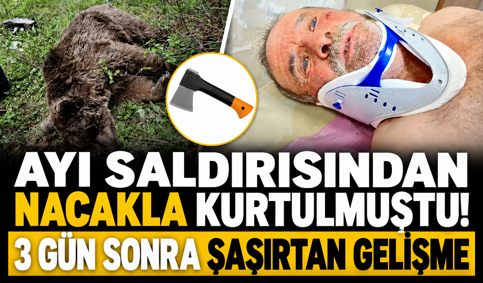 Ayı saldırısından nacakla kurtulmuştu! 3 gün sonra şaşırtan gelişme
