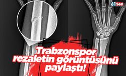 Trabzonspor rezaletin görüntüsünü paylaştı