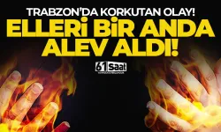 Trabzon'da korkutan olay! Elleri bir anda alev aldı...