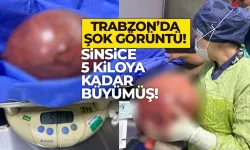 Trabzon’da şok görüntü!   Sinsice 5 kilo kadar büyüdü…