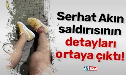 Serhat Akın saldırısının detayları ortaya çıktı!