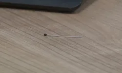 2 yaşındandaki bebeğin bağırsağından iğne çıktı