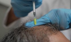 Dökülen saçlar vücudun bir alarmı olabilir