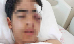 Akran zorbalığına bir yenisi eklendi:  15 yaşındaki çocuk...