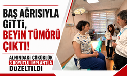 Baş Ağrısıyla Gitti, Beyin Tümörü Çıktı! Alnındaki Çöküklük 3 Boyutlu İmplantla Düzeltildi