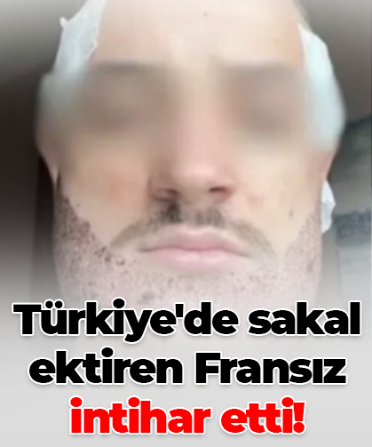 Türkiye'de sakal ektiren Fransız intihar etti!