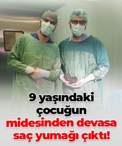 9 yaşındaki çocuğun midesinden devasa saç yumağı çıktı!