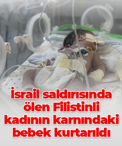İsrail saldırısında ölen Filistinli kadının karnındaki bebek kurtarıldı