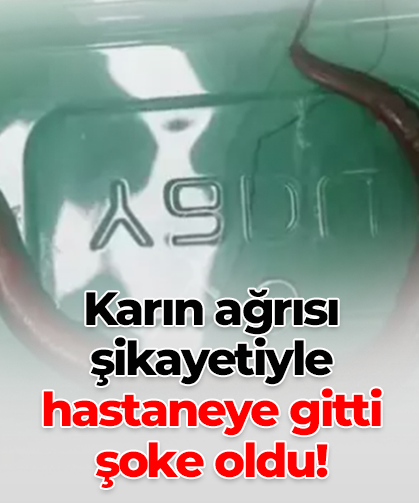 Karın ağrısı şikayetiyle hastaneye gitti şoke oldu!
