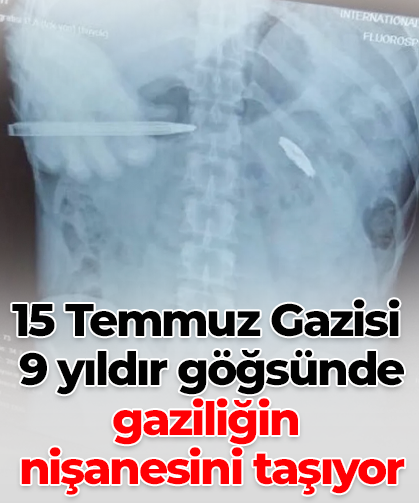 15 Temmuz Gazisi 9 yıldır göğsünde gaziliğin nişanesini taşıyor