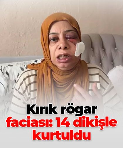 Elektrikli bisikletle kapağı kırık rögara düştü: Yüzüne 14 dikiş atıldı