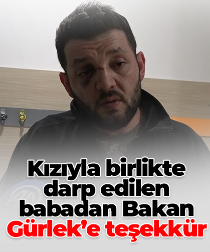 Kızıyla birlikte  darp edilen babadan Bakan Gürlek’e teşekkür
