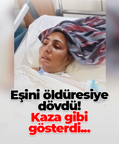Eşini öldüresiye dövdü! Kaza gibi gösterdi...