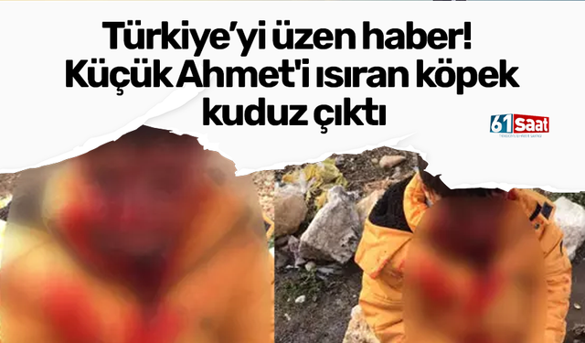 Türkiye’yi üzen haber! Küçük Ahmet'i ısıran köpek kuduz çıktı