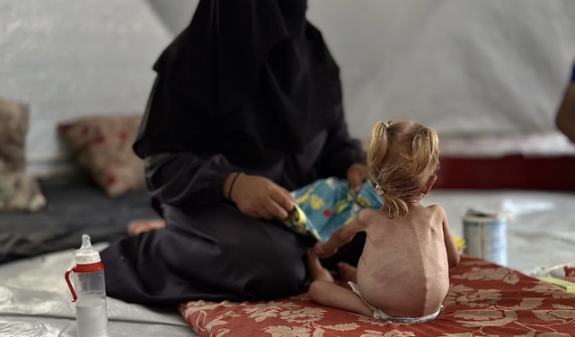 Gazze'de çocuklar açlıkla mücadele  ediyor!