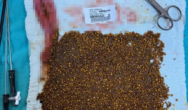 Manisa’da safra kesesinden 20 binden fazla taş çıkarıldı