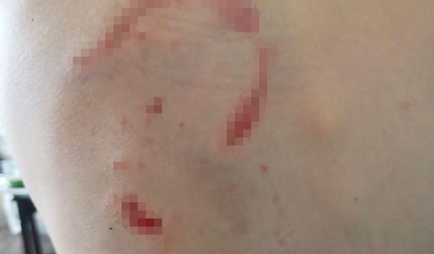 Vücudu köpek tarafından parçalanmıştı! Hayatı kabusa döndü