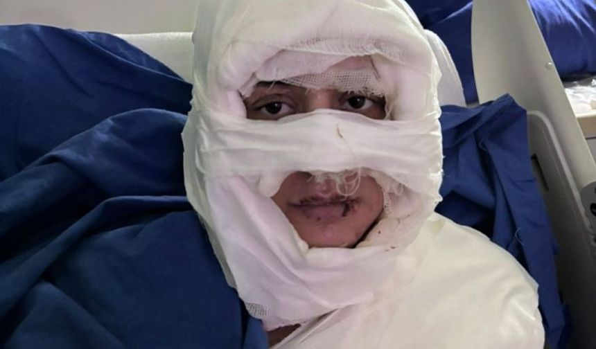 Genç kadın başka bir kadın tarafından  ateşe verildi