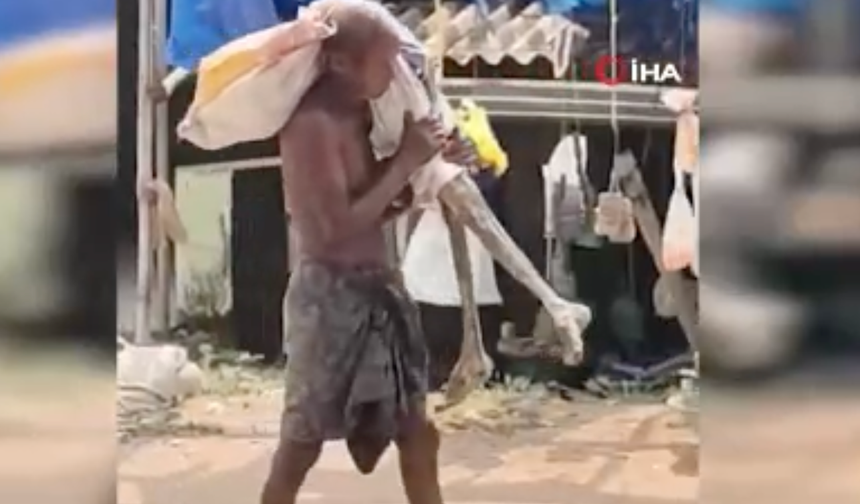 Bir adam para çekmek için kardeşinin iskeletiyle  bankaya gitti